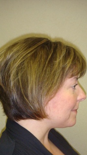 Before Hair Extensions, back view