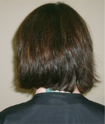 Before Hair Extensions, side view