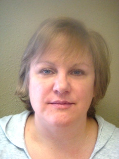 Before Hair Extensions, Front View
