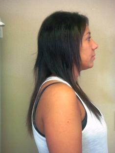 Before Hair Extensions, Side View