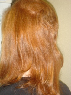 Before Hair Extensions, Back View