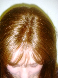 Before Hair Extensions, Back View