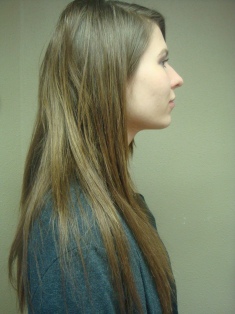 After Hair Extensions, Front View