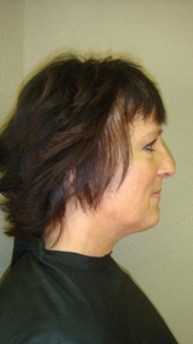 Before Hair Extensions, Side View