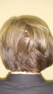 Before Hair Extensions, Side View