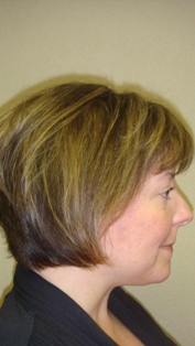 Before Hair Extensions, Back View