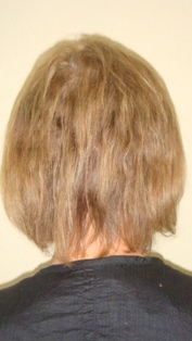 Before Hair Extensions, Back View