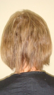 Before Hair Extensions, back view