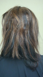 Before Hair Extensions, Side View