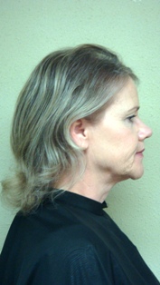 Before Hair Extensions, Back View
