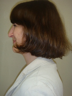 Before Hair Extensions, Side View