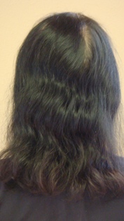 Before Hair Extensions, front view