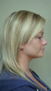 Before Hair Extensions, back view