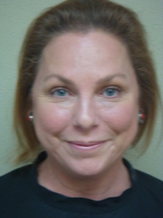 Before Hair Extensions, Front View