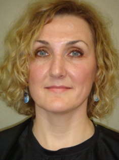 Before Hair Extensions, Front View