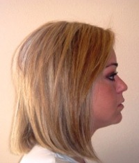 Before Hair Extensions, Side View