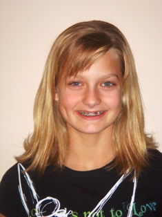 Before Hair Extensions, Front View