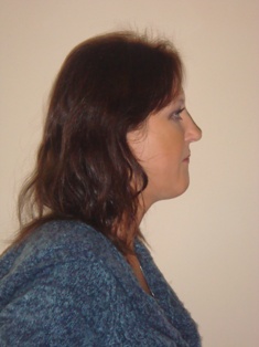 Before Hair Extensions, Side View