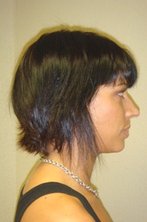 Before Hair Extensions, Front View