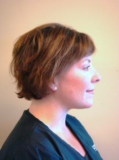 Before Hair Extensions, Side View