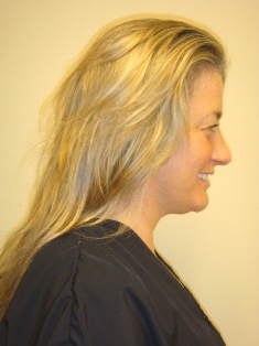 Before Hair Extensions, Front View