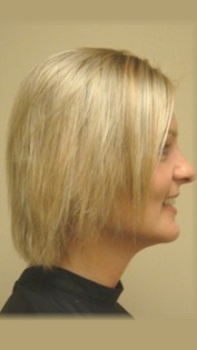Before Hair Extensions, Side View